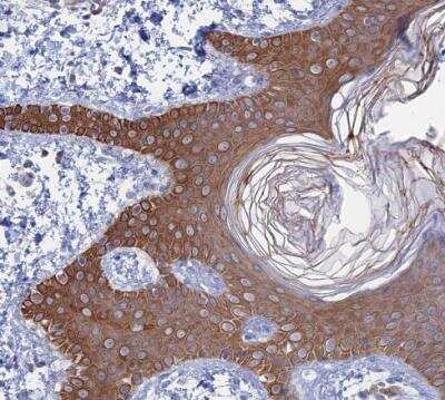 Immunohistochemistry-Paraffin: IL-7 Antibody [NBP1-83111]