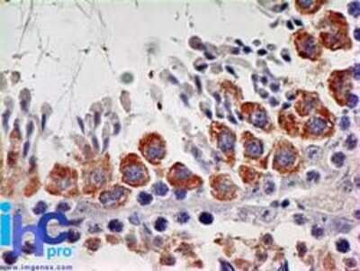 Immunohistochemistry-Paraffin: IL-7R alpha/CD127 Antibody (73N8F2) - Azide and BSA Free [NBP2-25264]