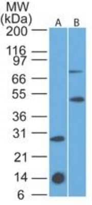 Western Blot: IL-7R alpha/CD127 Antibody (73N8F2)Azide and BSA Free [NBP2-25264]