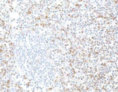 Immunohistochemistry: IL-7R alpha/CD127 Antibody (BLR177J) [NBP3-14749]