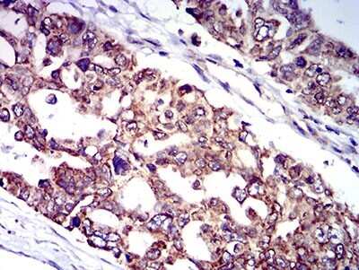 Immunohistochemistry-Paraffin: IL-9R Antibody (4A11H2) - BSA Free [NBP2-61701]
