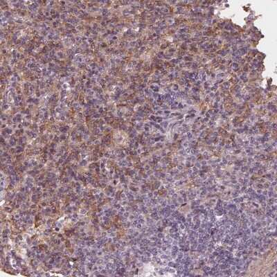 Immunohistochemistry-Paraffin: IL-9R Antibody [NBP2-68806]