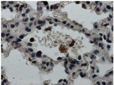 Immunohistochemistry: IL-1 RI Antibody (RM0013-11B7) - Azide and BSA Free [NB110-85471]