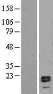 Western Blot: IL-1 beta/IL-1F2 Overexpression Lysate [NBP2-04165]