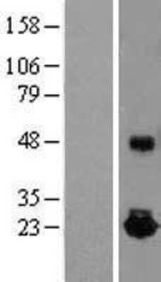 Western Blot: IL-10 Overexpression Lysate [NBL1-11895]