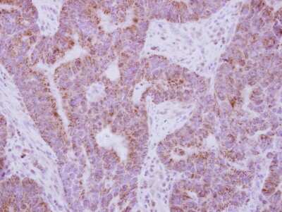 Immunohistochemistry-Paraffin: IL-10R alpha Antibody [NBP2-16941]