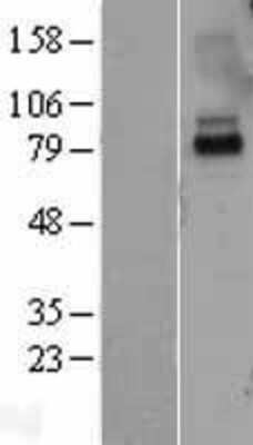 Western Blot: IL-10R alpha Overexpression Lysate [NBL1-11896]