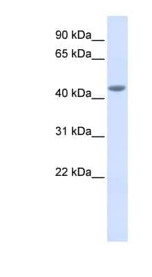 Western Blot: IL-11R alpha Antibody [NBP1-62351]