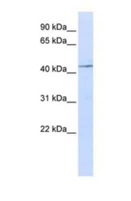 Western Blot: IL-11R alpha Antibody [NBP1-69375]