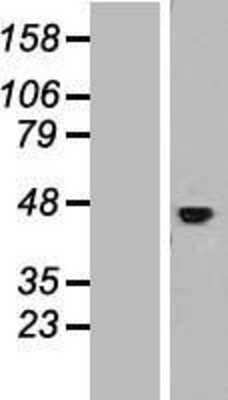 Western Blot: IL-11R alpha Overexpression Lysate [NBL1-11899]