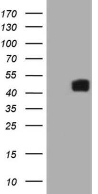 Western Blot: IL12B Antibody (OTI1A3) [NBP2-45391]