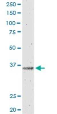 Western Blot: IL12B Antibody (2H6) [H00003593-M01]