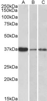 Western Blot: IL12B Antibody [NB100-61661]