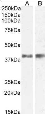 Western Blot: IL12B Antibody [NB100-93409]