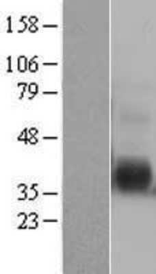 Western Blot: IL12B Overexpression Lysate [NBL1-11901]