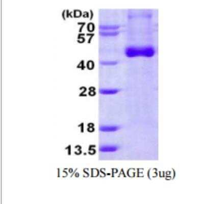 SDS-PAGE: Recombinant Human IL12B His Protein [NBP1-99042]