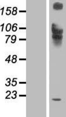 Western Blot: IL-12 R beta 1 Overexpression Lysate [NBP2-07735]