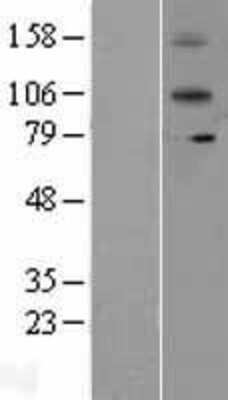 Western Blot: IL-12 R beta 2 Overexpression Lysate [NBL1-11903]