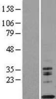 Western Blot: IL-13 Overexpression Lysate [NBL1-11904]