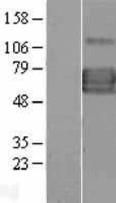 Western Blot: IL-13R alpha 1 Overexpression Lysate [NBL1-11905]