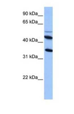 Western Blot: IL-13R alpha 2 Antibody [NBP1-69687]