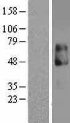 Western Blot: IL-13R alpha 2 Overexpression Lysate [NBL1-11906]