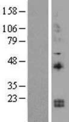 Western Blot: IL-15 Overexpression Lysate [NBL1-11907]