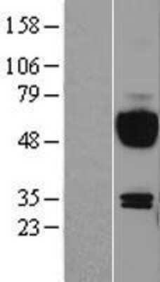 Western Blot: IL-15R alpha Overexpression Lysate [NBL1-11909]