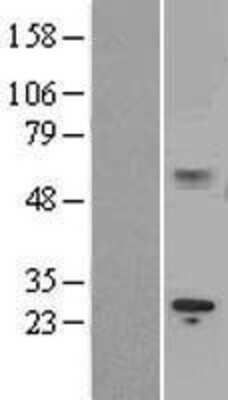 Western Blot: IL-15R alpha Overexpression Lysate [NBL1-11910]