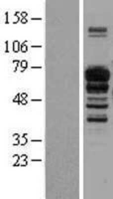 Western Blot: IL-16 Overexpression Lysate [NBL1-11911]