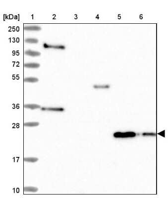 Western Blot: IL-17B Antibody [NBP1-83113]