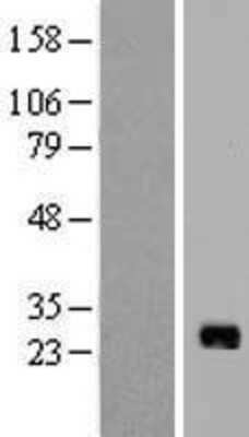 Western Blot: IL-17B Overexpression Lysate [NBP2-07333]