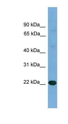 Western Blot: IL-17D Antibody [NBP1-79686]