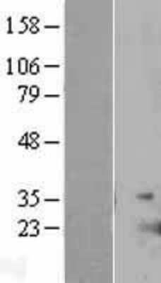 Western Blot: IL-17E/IL-25 Overexpression Lysate [NBL1-11946]