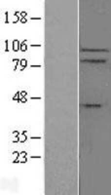 Western Blot: IL-17RC Overexpression Lysate [NBL1-11917]