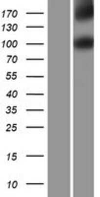 Western Blot: IL-17RD/SEF Overexpression Lysate [NBP2-06962]