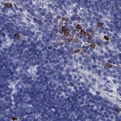 Immunohistochemistry-Paraffin: IL17REL Antibody [NBP1-93769]