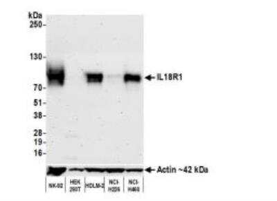 Western Blot: IL18R1 Antibody (BLR172J) [NBP3-14745]