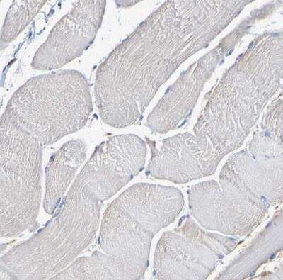 Immunohistochemistry-Paraffin: IL18R1 Antibody [NBP1-85782]