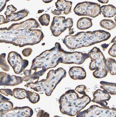 Immunohistochemistry-Paraffin: IL18R1 Antibody [NBP1-85782]