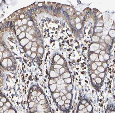 Immunohistochemistry-Paraffin: IL18R1 Antibody [NBP1-85782]