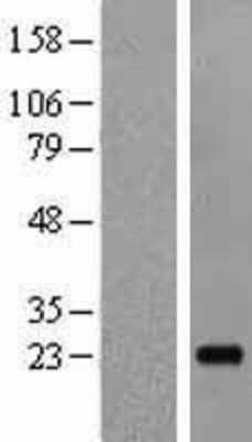 Western Blot: IL-19 Overexpression Lysate [NBL1-11921]