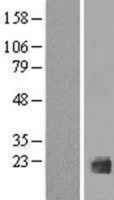 Western Blot: IL-38/IL-1F10 Overexpression Lysate [NBP2-06002]