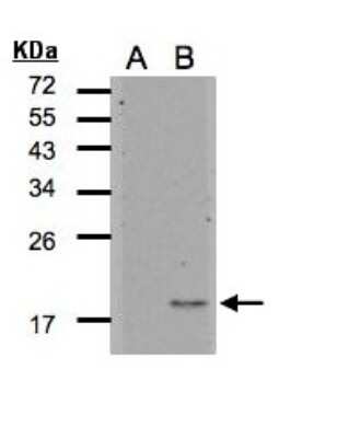 Western Blot: IL-36Ra/IL-1F5 Antibody [NBP2-16945]