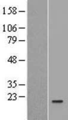 Western Blot: IL-36Ra/IL-1F5 Overexpression Lysate [NBL1-11924]