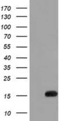 Western Blot: IL-36 alpha/IL-1F6 Antibody (OTI1A4) [NBP2-02758]