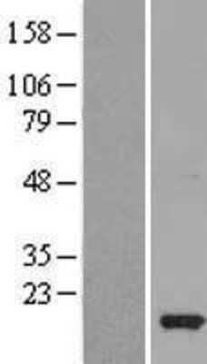 Western Blot: IL-36 beta/IL-1F8 Overexpression Lysate [NBL1-11926]