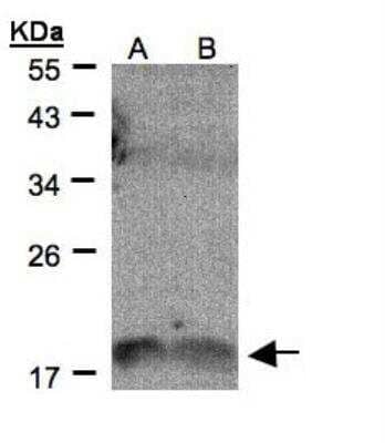 Western Blot: IL-36 gamma/IL-1F9 Antibody [NBP1-31185]