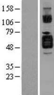 Western Blot: IL-1 RII Overexpression Lysate [NBL1-11927]