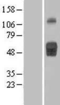 Western Blot: IL-1 RII Overexpression Lysate [NBL1-11928]